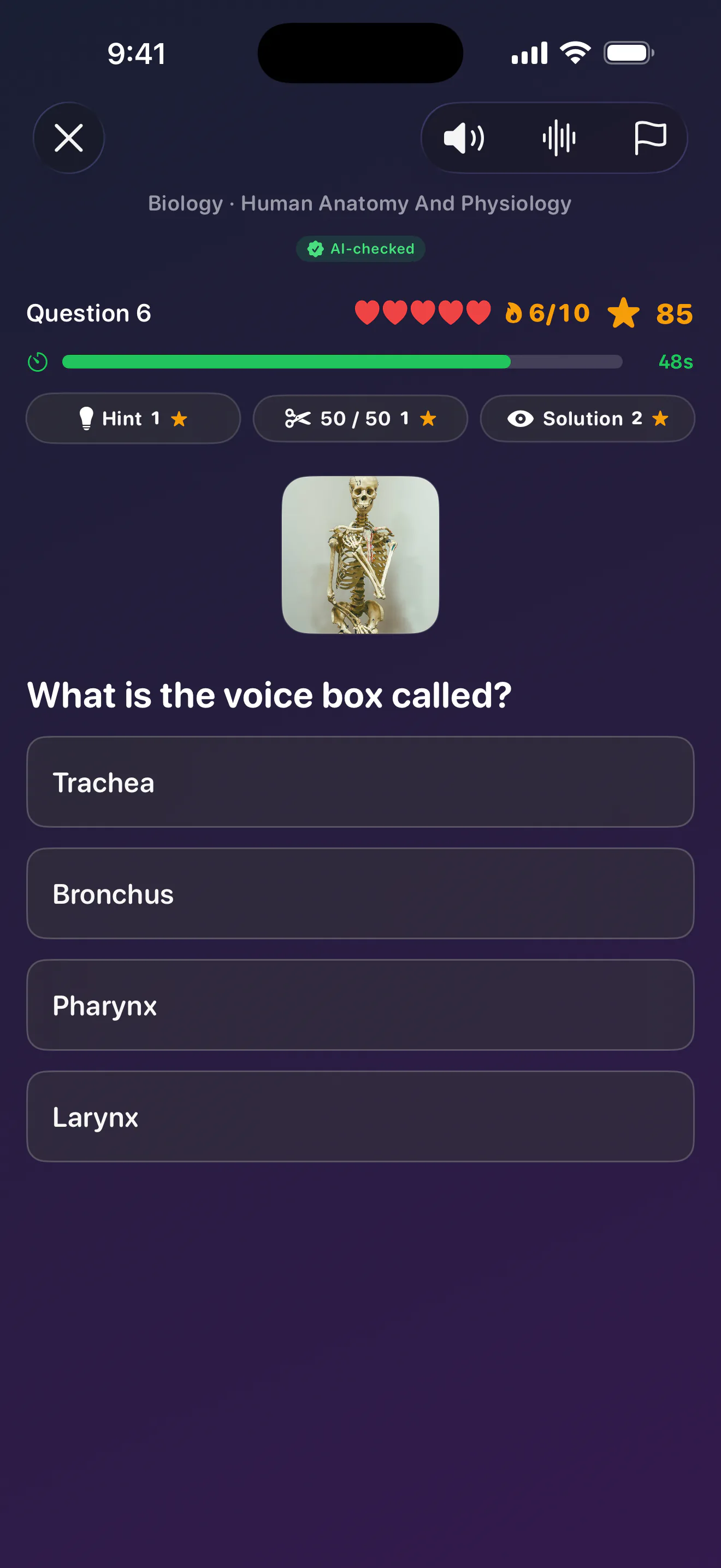 A multiple-choice quiz question with four answers, five lives, and a countdown bar.